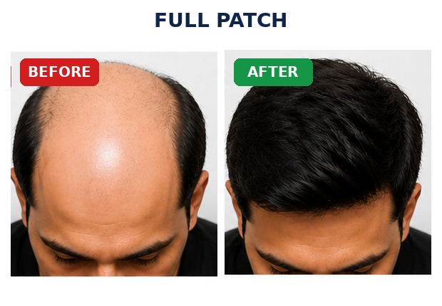 Full Patch before and after